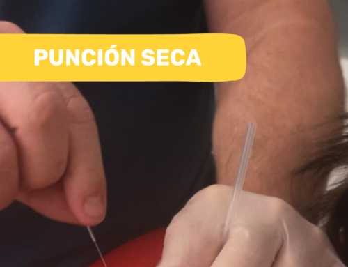 Punción Seca: Guía Completa 2025