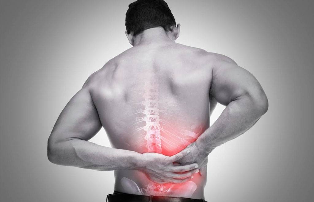 ciática lumbar