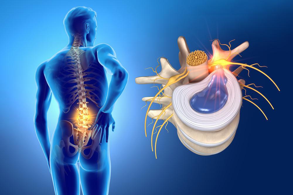 terna discal