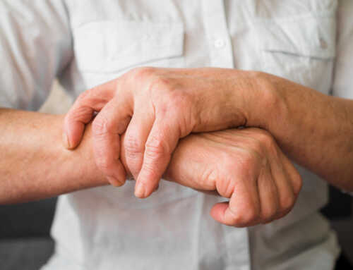 Rizartrosis: Qué es, Causas y Tratamiento